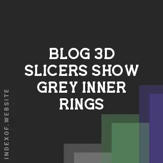 Why 3D Slicers Show Grey Inner Rings (Not Printing Fix) | Logo - Indexof